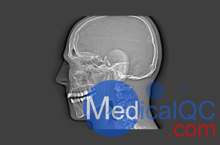 CIRS 711-HN頭部模體，CIRS 711-HN CBCT模體