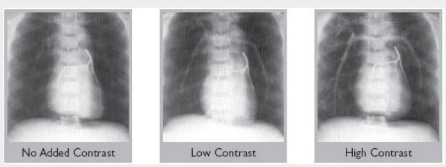 RSD RS-320胸/肺模體，RSD RS-320肺部模體,RSD RS-320胸部模體