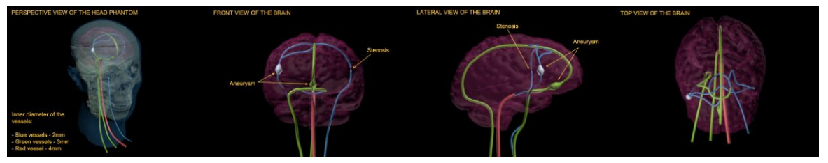 True phantom動(dòng)態(tài)成人人體頭部模體影像效果