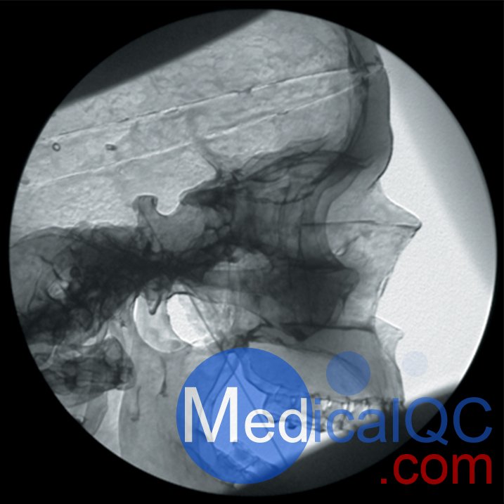 AR351脊椎穿刺模體，Adam，Rouilly脊椎穿刺模體