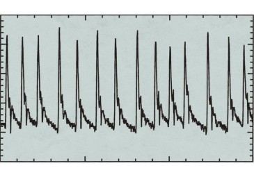Multi+ 可變波形軟件，心律失常