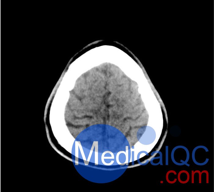 50-01頭部CT模體，50-01腦中風(fēng)頭部模體，50-01腦出血頭部模體