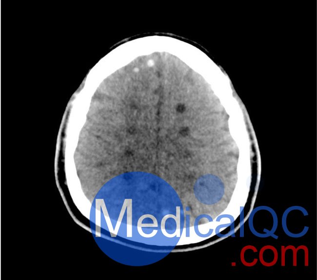 50-01頭部CT模體，50-01腦中風(fēng)頭部模體，50-01腦出血頭部模體