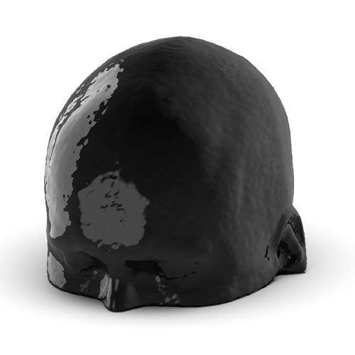 WEK50-04 CTA頭模，帶AVM CTA頭模，WEK50-04 CT血管造影頭模