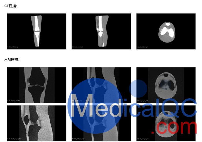 KE-A03成人膝關(guān)節(jié)，KE-A03膝關(guān)節(jié)模體,KE-A03膝關(guān)節(jié)模型成像效果圖