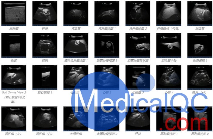 US-A04 FAST訓(xùn)練軀干模體，US-A04超聲軀干模體