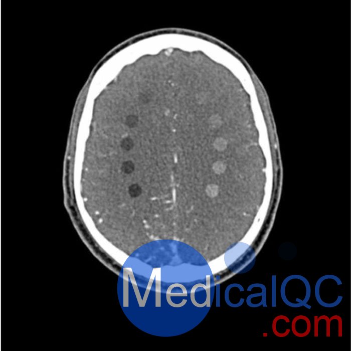 WEK-5005腦血管造影頭模，WEK-5005頭模， CTA AVM頭模成像效果圖