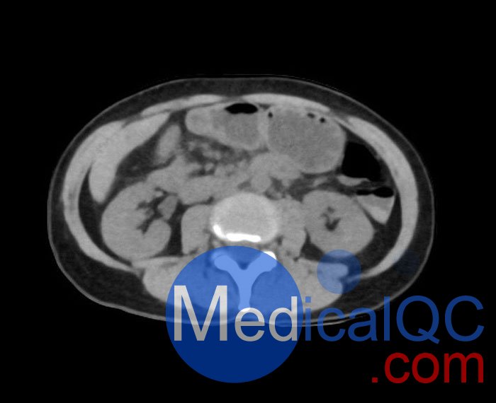 WEK55-02腹部骨盆模體，WEK55-02腹部骨盆模型成像效果圖
