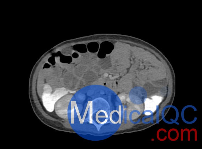 WEK58-03兒童軀干模型，WEK58-03兒童軀干模體成像效果圖