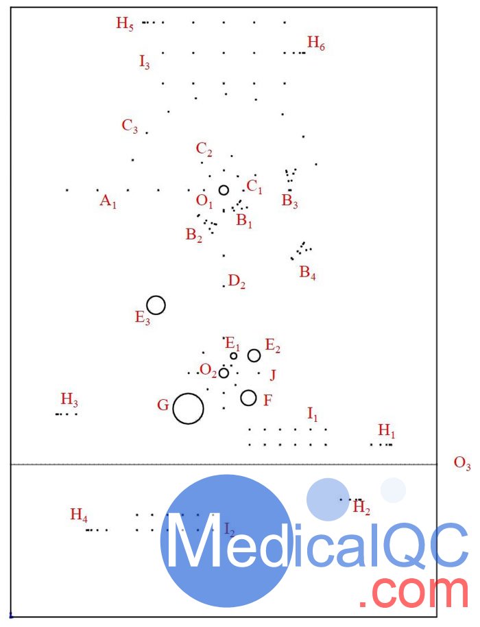 KS107QN-4A型體模探查孔、靶線及模擬病灶分布