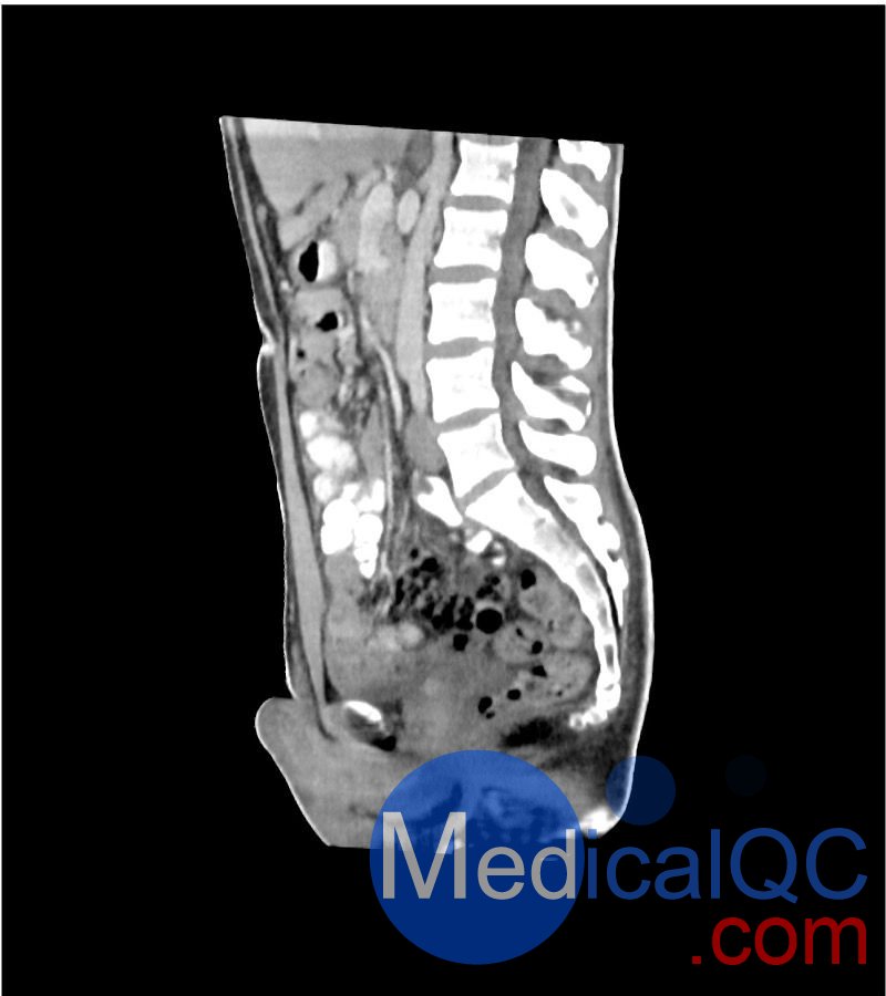 WEK-5501男性腹部模體，WEK-5501男性骨盤模體