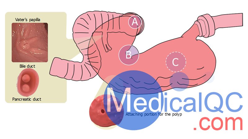 LM-103胃腸鏡模擬器，LM-103胃腸模體，EGD模擬器